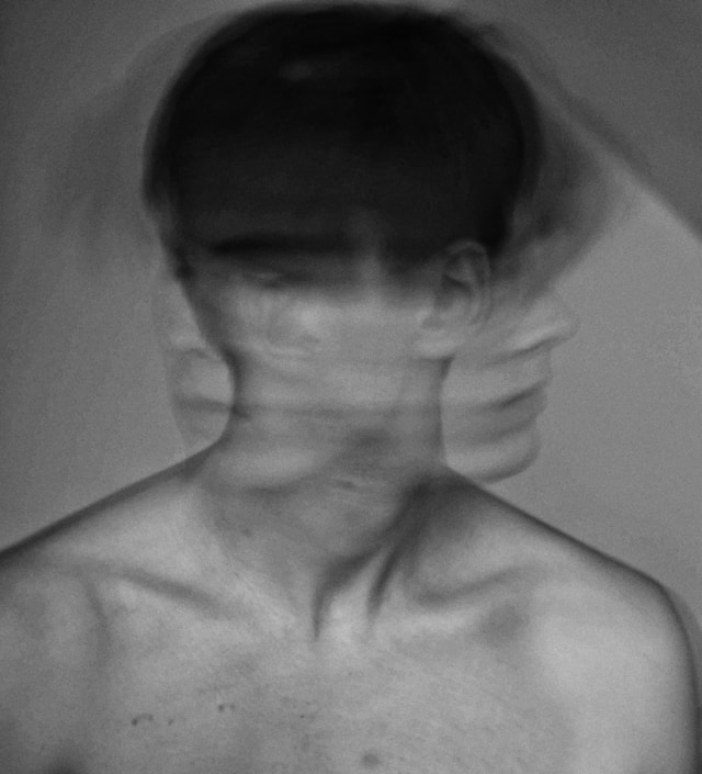 Bipolar Bozukluk
